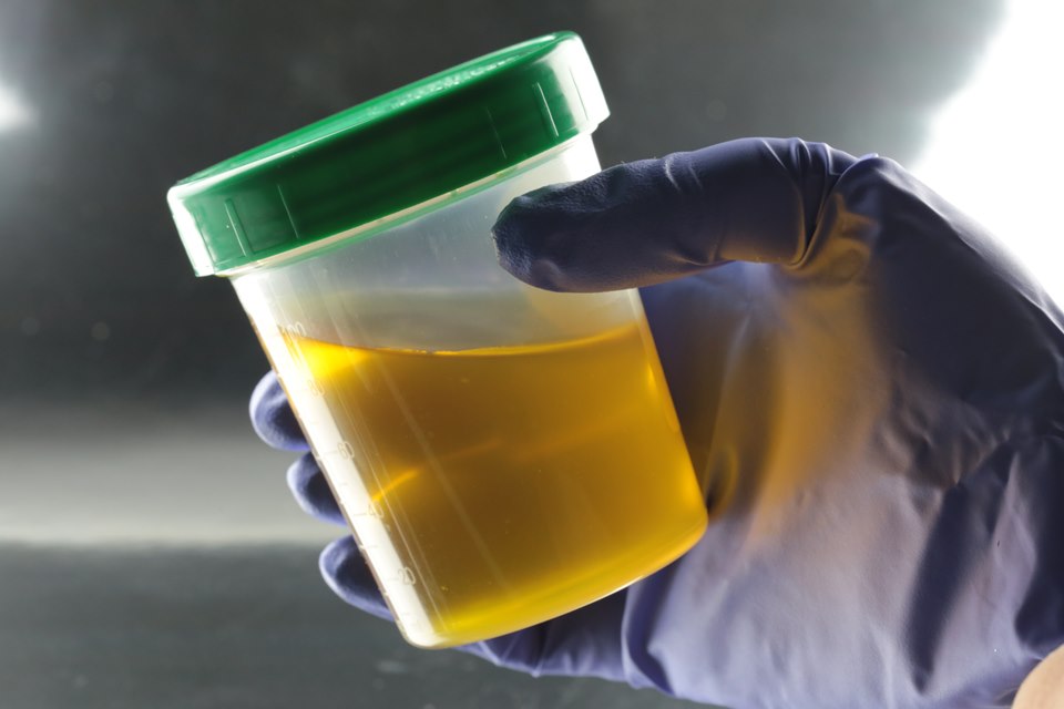 Foto de mão com luva segurança fresco com urina - Metrópoles