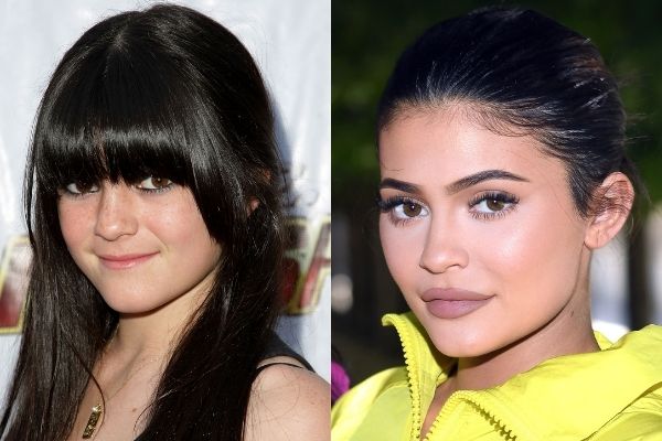 Kylie jenner antes e depois