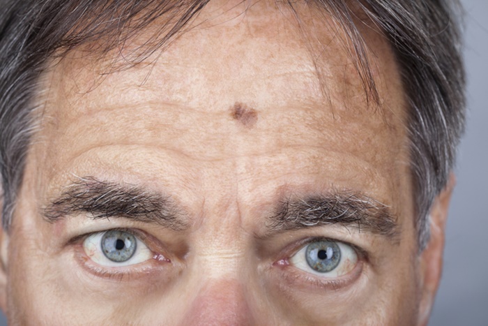 Parte superior de um rosto masculino. Os olhos são auis, o cabelo, grisalho e a pele está enrugada- Metrópoles
