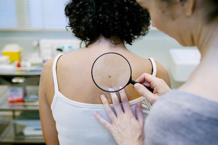 Médico investigando pele de paciente- Metrópoles