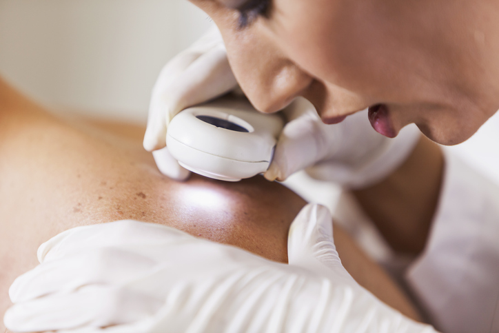 Médico investigando pele de paciente- Metrópoles