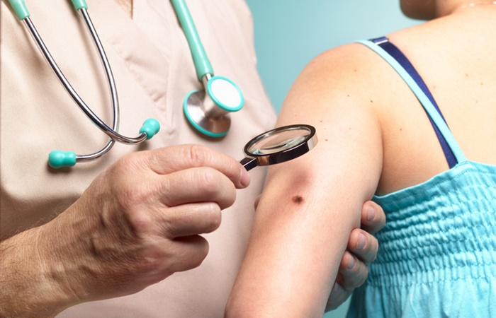 Médico investigando pele de paciente- Metrópoles