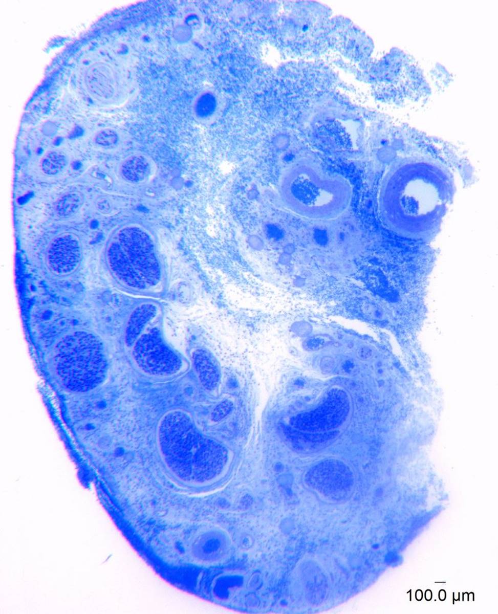 Imagem de microscópio ampliada mil vezes mostra terminações nervosas do clitóris - Metrópoles