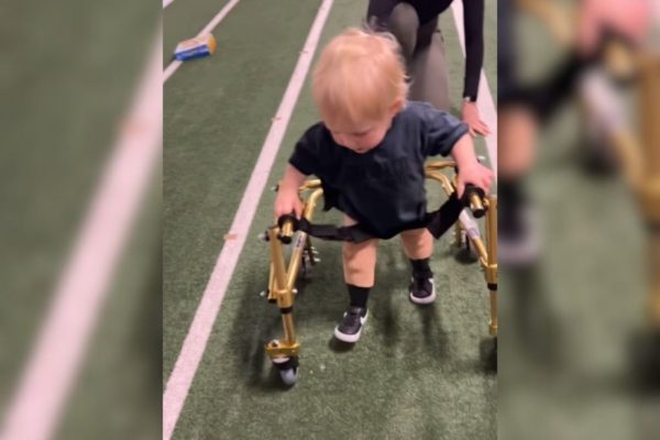 Imagem colorida de bebê com próteses caminhando com a ajuda de andador
