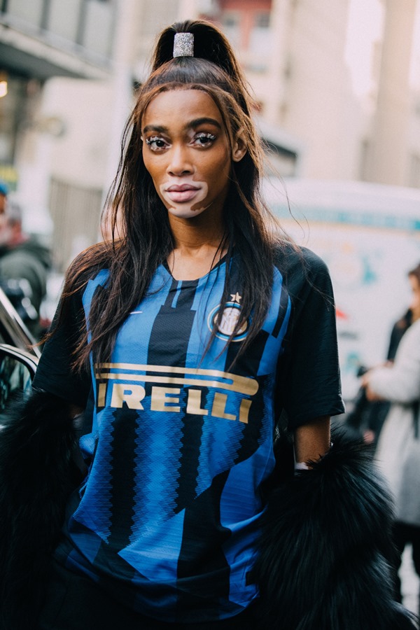 Modelo Winnie Harlow, negra com manchas de vitiligo, caminha com camisa do time italiano Inter de Milão - Metrópoles