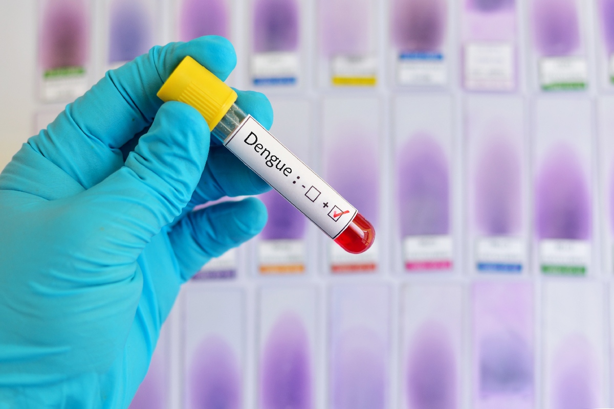 Dengue: sintomas e o que fazer quando as plaquetas estão baixas ...