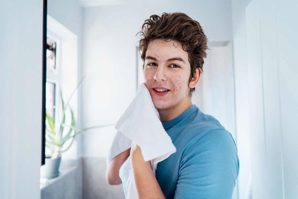 Retrato de adolescente sorridente com problema de acne que cuida da pele do rosto em casa. Ele se olha no espelho e enxuga o rosto com uma toalha no banheiro - Metrópoles