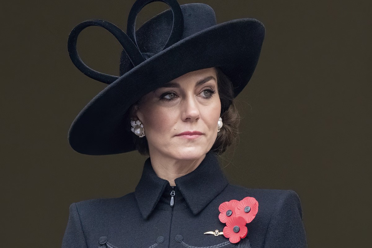 Kate Middleton já iniciou o tratamento de quimioterapia