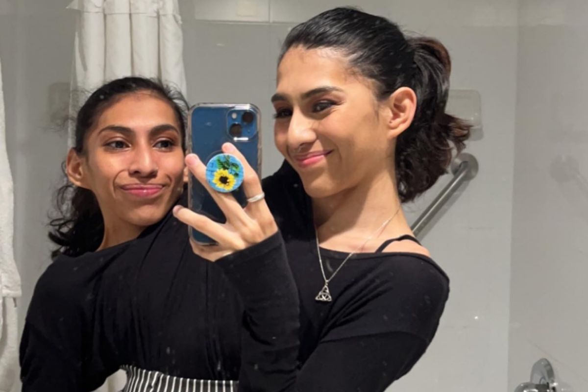 Gêmeas siamesas Carmen e Lupita - Foto: Reprodução/Instagram
